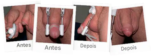 Antes e depois do cliente 1