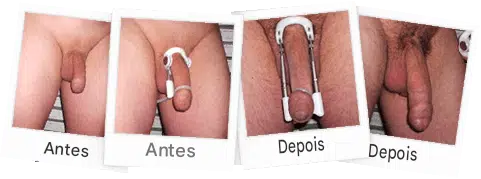 Antes e depois do cliente 3