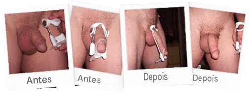 Antes e depois do cliente 4