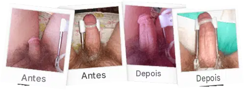 Antes e depois do cliente 5