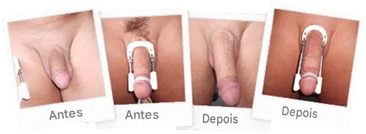 Antes e depois do cliente 6